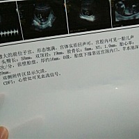 有没有会看的?有没有什么问题，问医生，医生都没说，但是又说要复查，不懂什么意思。