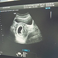 八周三天的，“茄子”……