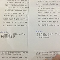 36周了，宝呀，这都一个月过去了，你咋还没绕出来呀。