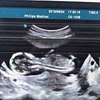 帮忙看看男孩女孩