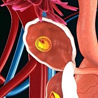 卵巢早衰很可怕！女性朋友一定要学会预防卵巢早衰！巢位于子宫底的后外侧，与盆腔侧壁相接。它和子宫都...