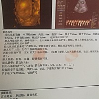 不知道是男孩女孩？？？