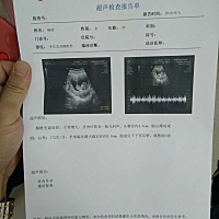 孩子很健康，11 周成型了