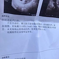 怀孕2个月了 胎芽才0.4cm 胎心还没有检查到 我这个希望还大不