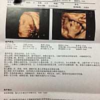 男宝宝女宝宝呢？