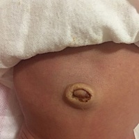 肚脐带9月5号掉的，找不到了