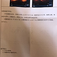 我的多囊严重吗？30岁了 好担心啊 家里催的又急 我这样有希望吗？