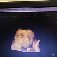 男孩叫张昊辰或者张玉昕，女孩张宛昕，怎么样重复率高不