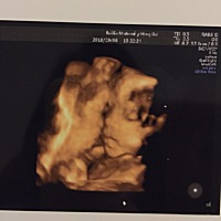 第一次跟宝宝见面、有经验的宝妈们帮忙看看像女宝还是男宝、很好奇……