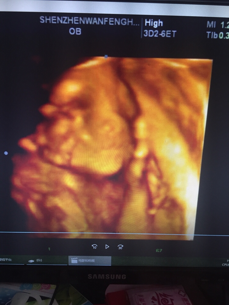 感觉跟四维上一点都不像，像爸爸多点