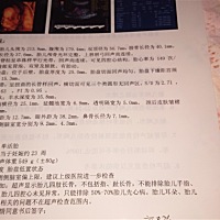 谁会看单子，帮忙看看