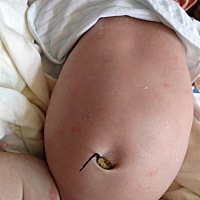 有经验的宝妈帮看一下宝宝肚子上长了好多小红点 是怎么回事？