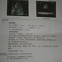 麻烦大家帮我看看这个NT的检查结果怎么样，医生说正常。但是看大家晒出来的NT值都比我低，我的是0.20，...