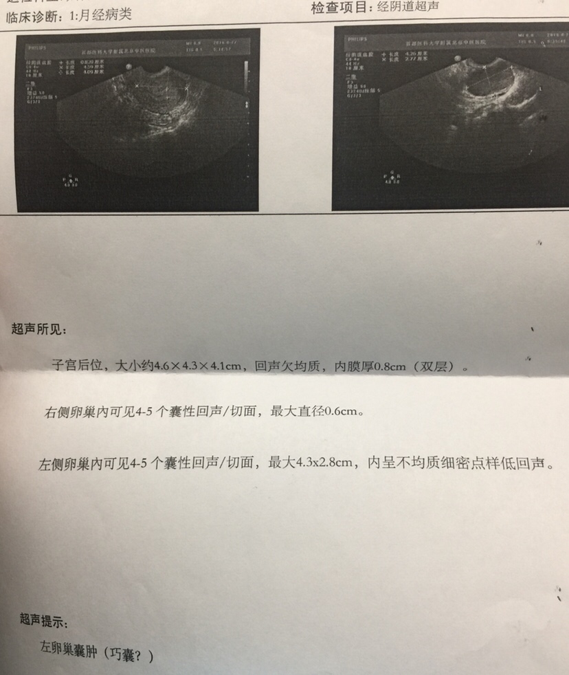 这张是8月底拍的，（大概例假前4、5天）