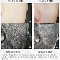 【25岁以后才需要抗衰老？】 著名抗老专家、哈佛医学博士认为“人体的衰老是从形成胚胎时开始” 18岁以...