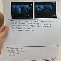 这就是久久未怀上宝宝的原因吗？有同样经历的姐妹吗？