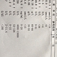 医生说宝宝的黄疸指数很高，叫去照蓝光，可是一去就一个星期见不到宝宝，很无助……有懂看的孕妈宝妈吗...