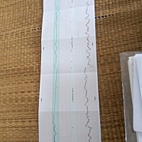 39 4周胎心检查第三次了，最后还是吸氧，还是三天，每次结果都不一样服了