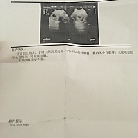 检查一下就放心啦