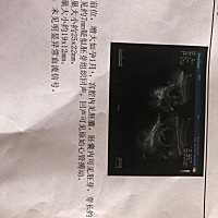 今天去检查胎心，做比超医生说胎芽旁边还有一个七毫米的东西，但不明什么，朋友们帮我看看，你们有遇到...