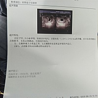 怀的胚芽正常吗