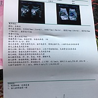 今天去做了个三维