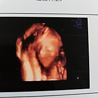 能不能看到大眼睛高鼻梁。求告知