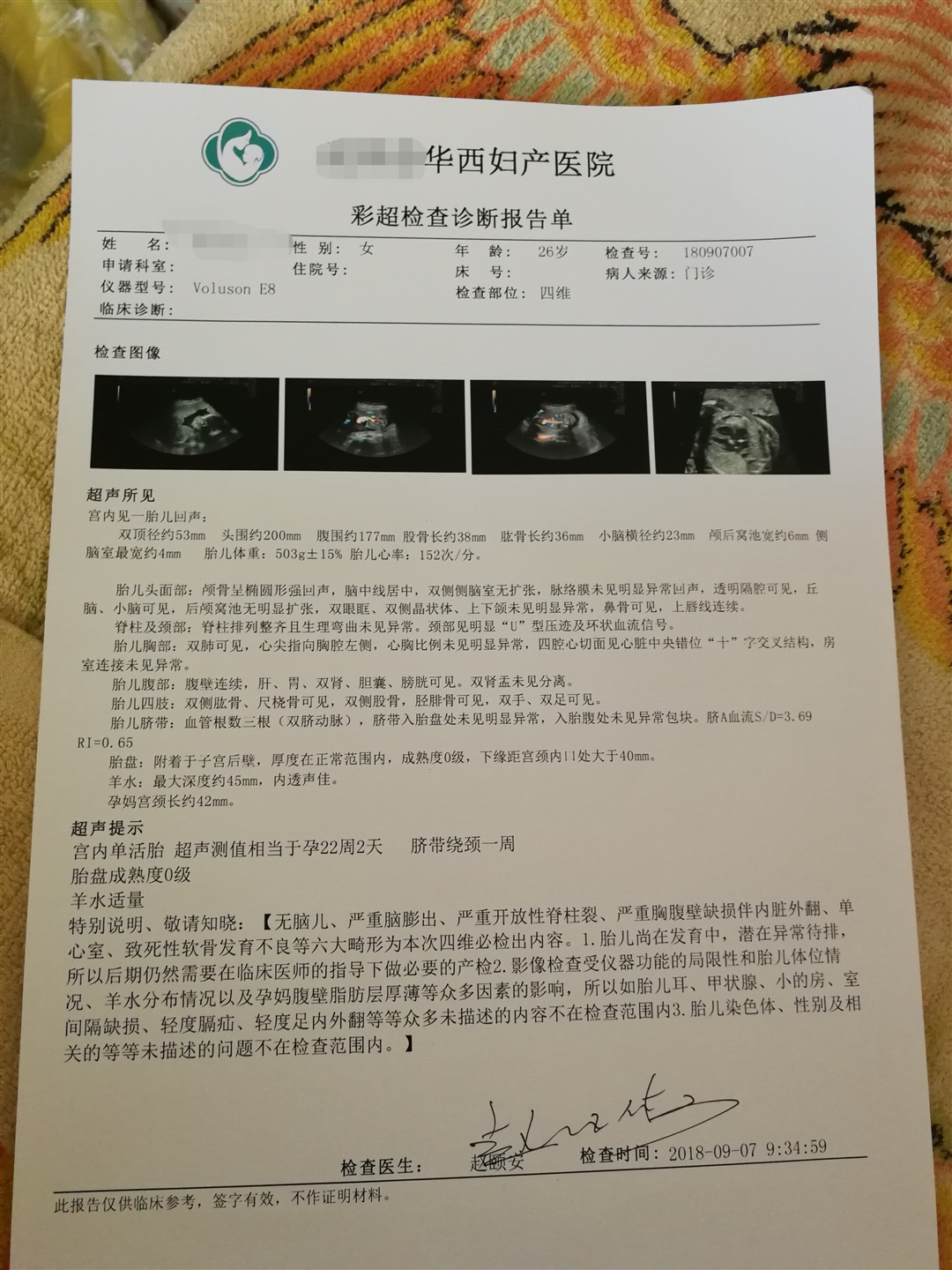 脐带绕颈一周，怎么办才好～～～