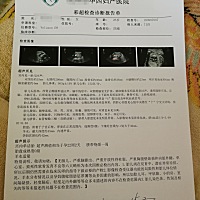 四维前几天已做，可是心情好不起来😒😒😒 脐带绕颈一周，怎么办才好～～～