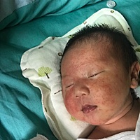 宝宝出生十九天了，脸上长了好多粉刺一样的痘痘，不知道是痱子还是湿疹，急死了，去医院检查叫我们回家...