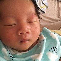 请问一下宝宝脸上长的是什么 要做什么处理吗？