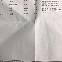 多囊 经期第三天检查了性六项 懂的帮我看看 我就看懂泌乳素高