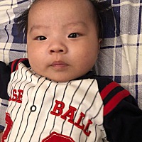 宝妈们看一下，我的宝宝像是唐氏儿吗？孕期做过检查没事，但是这几天我怎么越看越像，是不是心理的问题