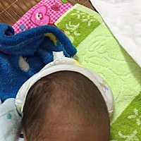 有经验的宝妈，帮看一下，头发稀少，好担心