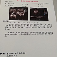 好奇是男是女？