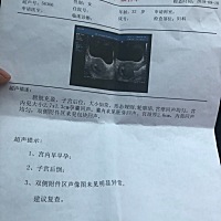 怀孕47天了，还没有胚芽，是不是危险了，我看着个孕囊长的又细又长的。是不是发育不好啊！好担心啊