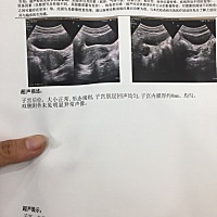 子宫后位影响怀孕吗亲