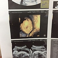 新鲜出炉的三维照 宝妈们 帮我看看两个宝宝像不像 b