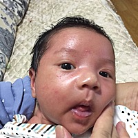 宝宝脸上有红疙瘩怎么办啊，哪位宝妈有好办法没有，宝宝现在25天了