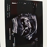 今天做了NT，12周零2天，不知是男孩还是女孩，好奇