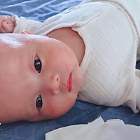 宝贝脸上长湿诊了！涂什么药好的快一点