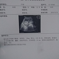 三个月的b超，会看的帮我看下发育的挺好的吧！