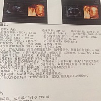 四维顺利通过.能看出来男宝女宝吗？