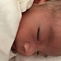 宝贝有点起红色小米粒 怎么办？