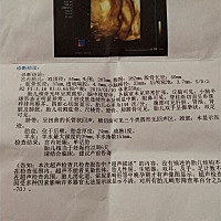 今天四维彩超通过   各位亲们有谁能看的懂是男孩女孩吗