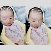 我宝宝11天了，是不是很可爱，预产期当天生的，头天晚上十一点破水了，住院到第二天早上九点挂催产素，...