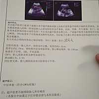 能看出性别吗？