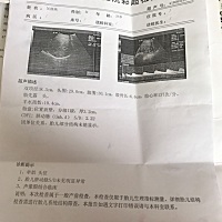 各位宝妈能帮忙看一下是男孩女孩吗？大约体重？突然好好奇。