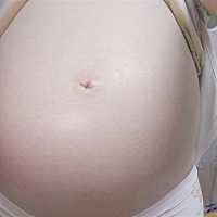 六个月的肚子这么大正常吗？感觉自己肚子比别人小好多，好多人肚子中间有一条黑线，为啥我没有😂😂