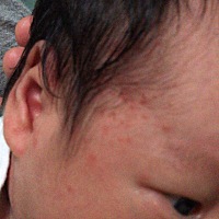 马上满月了，但是宝宝身上脸上这个红点点越来越多了，而且拍照没有拍清楚，近看密密麻麻的吓人，家人说...